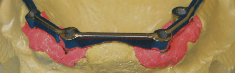 Hader Bar Frame